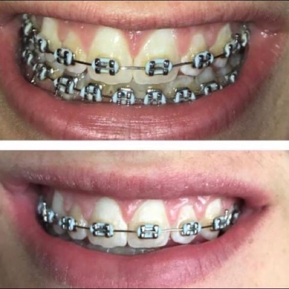 Whitening Toothpaste - Picture 3 of 6